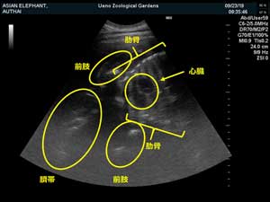 腹部超音波検査の画像